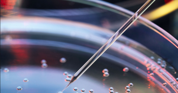 Células-tronco ajudam a recuperar área cerebral danificada por AVC