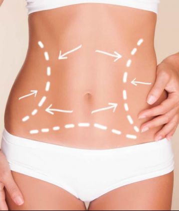 Conheça seis cirurgias para eliminar a flacidez